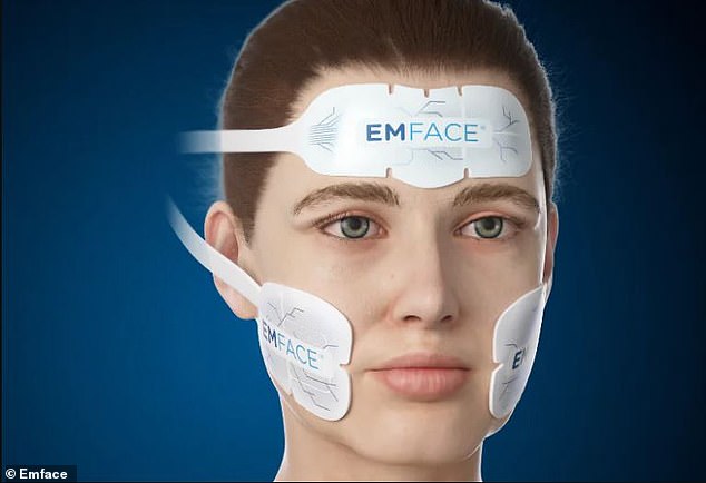 The procedure, called EMFACE hones and tones neck fat using a pad placed under the chin that emits high-intensity electromagnetic energy