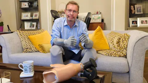 Michael Keohan Craig Mackinlay sitting on a sofa at his home, with prosthetic limbs he has paid for and NHS replacement limbs in front of him.