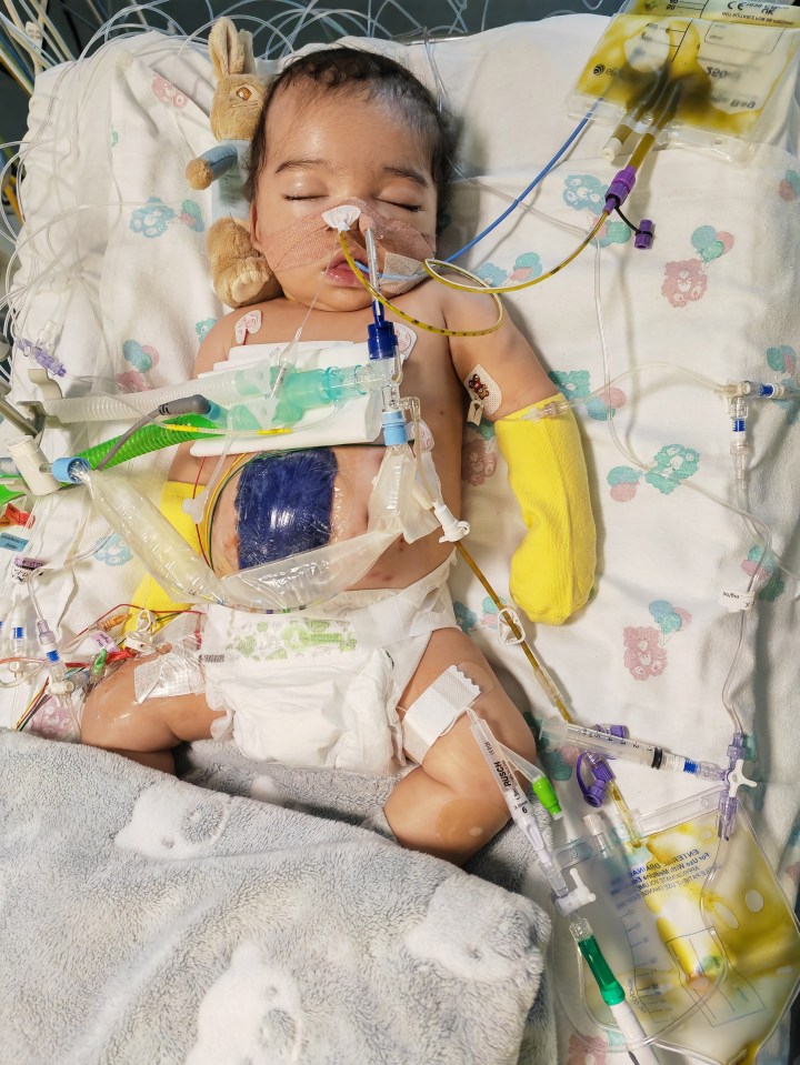 The stricken tot as he fought for life in hospital