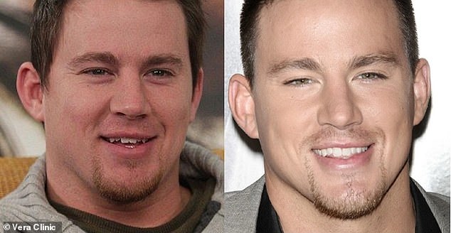 The Magic Mike star's smile is not perfect - but his teeth are now far whiter than they appeared far earlier in his career