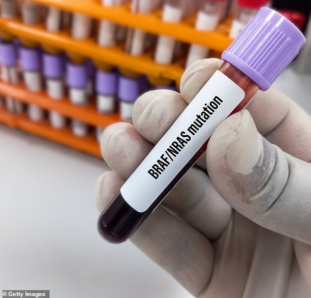 A blood sample taken as part of testing for the mutation. Most sufferers do not live longer than ten months after diagnosis