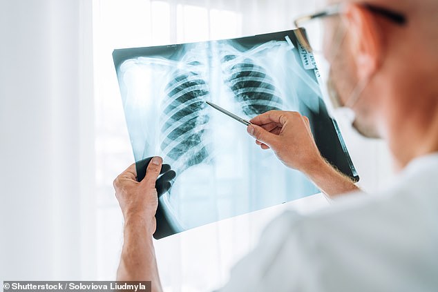 Although small, these particles are thought to cause inflammation in the lungs which can wake up normally inactive cells which can lead to cancer-causing mutations and tumours