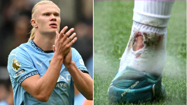 Erling Haaland was spotted with blood on his socks during Man City's 1-1 draw against Newcastle