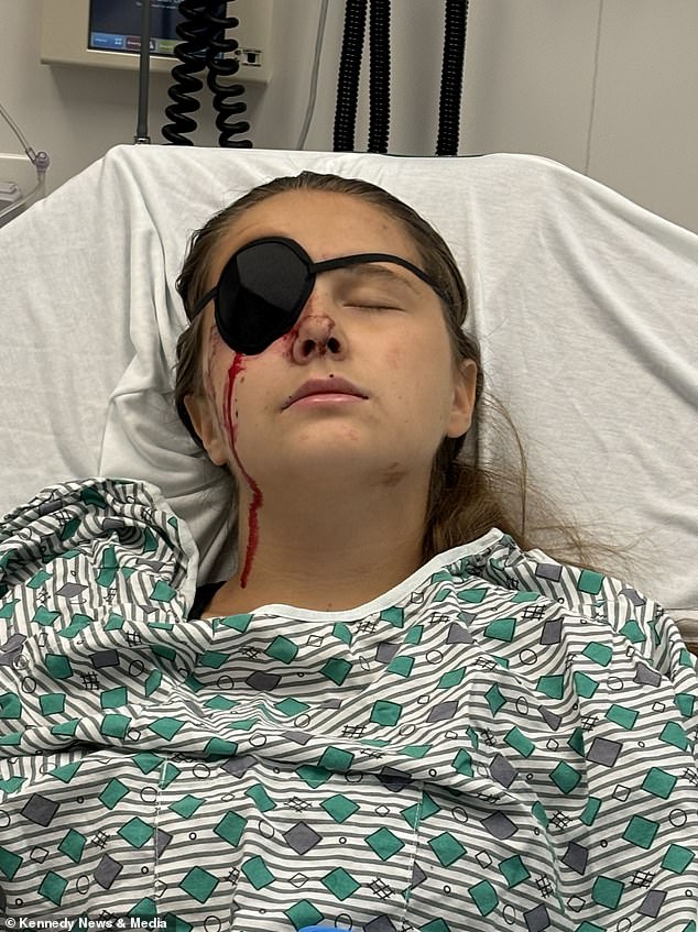 The teen arrived at the hospital covered in blood with a bruised right eye