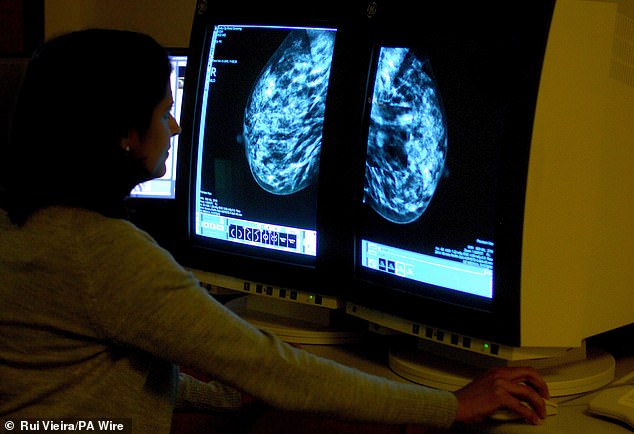 A consultant analysing a mammogram for breast cancer. Triple negative breast cancer can be caused by a fault in the BRCA genes which increases the chances of developing certain types of cancer