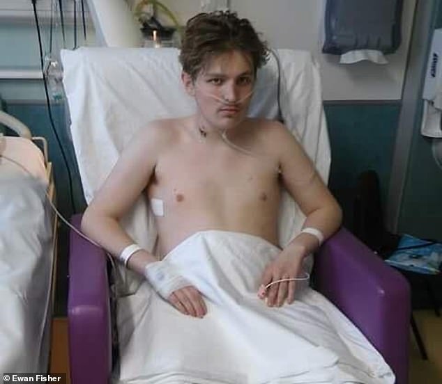 The then 16-year-old Ewan Fisher needed an artificial lung to survive and spent 10 weeks in hospital as doctors fought to save his life