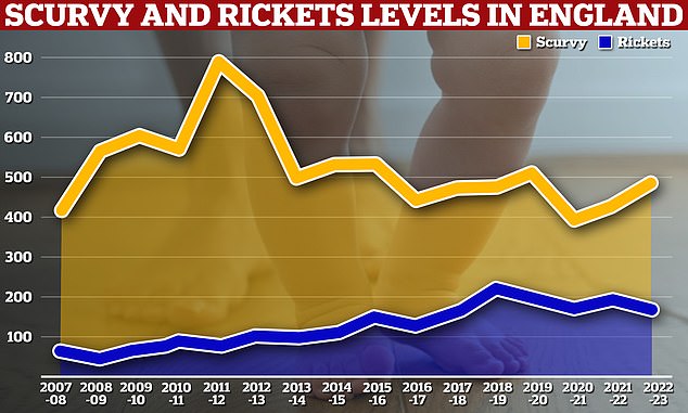 The statistics also revealed 171 people were treated with scurvy and 482 for rickets, with 405 of these patients being children